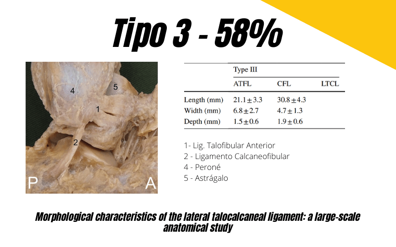 3.  Ligamento talocalcaneo lateral Ecografia tempo formacion.png